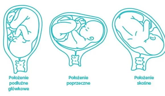 Kiedy płód układa się do porodu i co to oznacza dla mamy? Kiedy płód układa się do porodu i co to oznacza dla mamy?